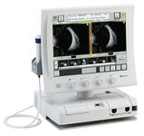 Ультразвуковой сканер UD-8000 Tomey